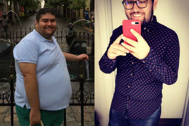 Rogelio's Story - Before and After Gastric Sleeve Surgery