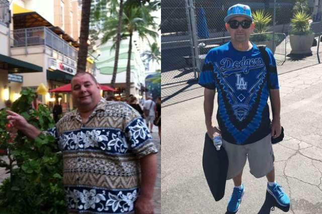 James' Story - Before and After Gastric Sleeve Surgery