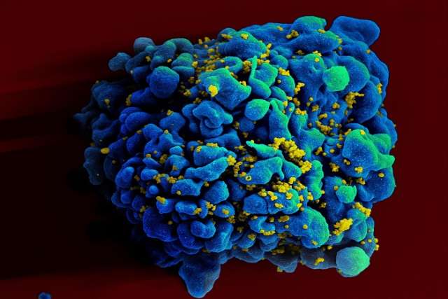 HIV-infected H9 t-cell
