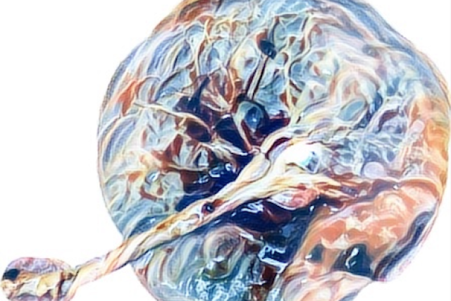medical illustration of a magnolia placenta 