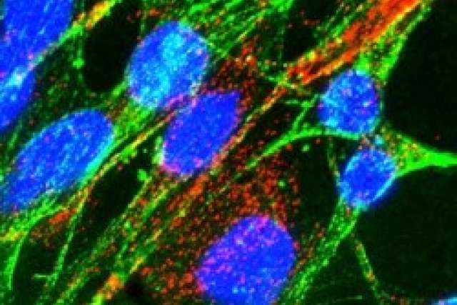 Malignant gliomas are among the most lethal cancers and the second-leading cause of cancer death among young adults.