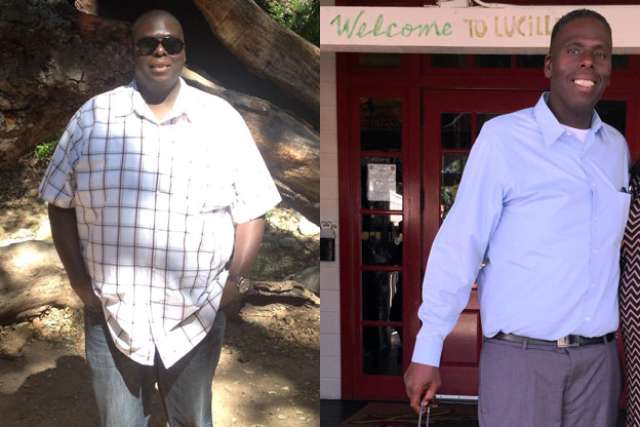 Randall's Story - Before and After Gastric Bypass Surgery