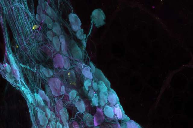 Fluorescent microscopy of a heart artery shows blue vessel structures and purple cells clustered within, against a dark background.