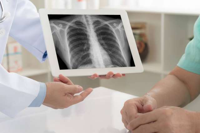 A doctor in a white coat holds a tablet displaying a chest X-ray while talking to a patient sitting across a white table.