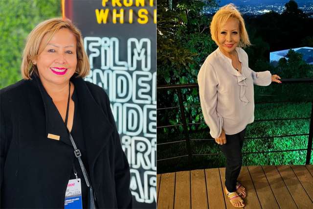 Sandra - Before and After Gastric Sleeve Surgery at UCLA