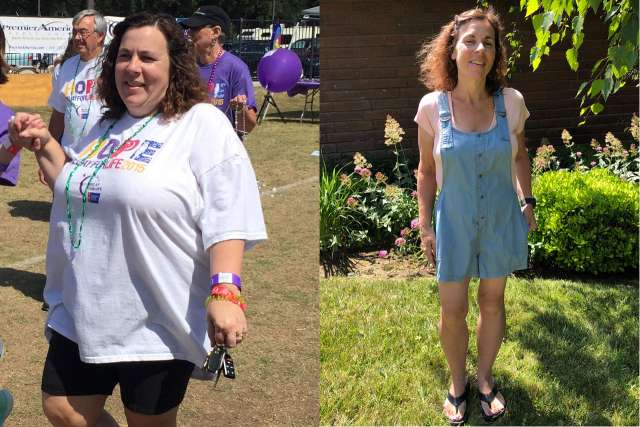Michaele's Story - Before and After Gastric Sleeve Surgery