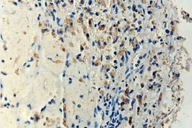 Image of Toca 511 virus