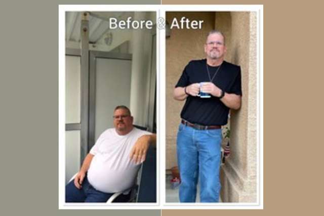 Frank's Story - Weight Loss Surgery: Gastric Sleeve