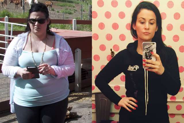 Kallista's Story - Before and After Gastric Sleeve Surgery