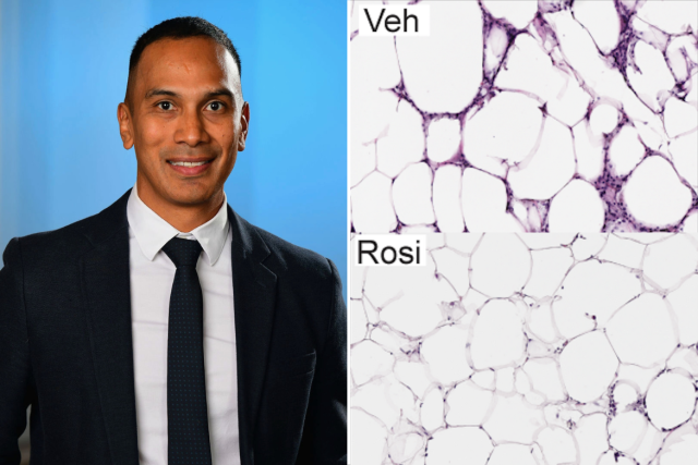 Dr. Claudio Villanueva and microscopic views of fat cells showing side by side.