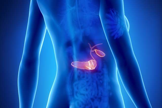 3D illustration of pancreas cancer