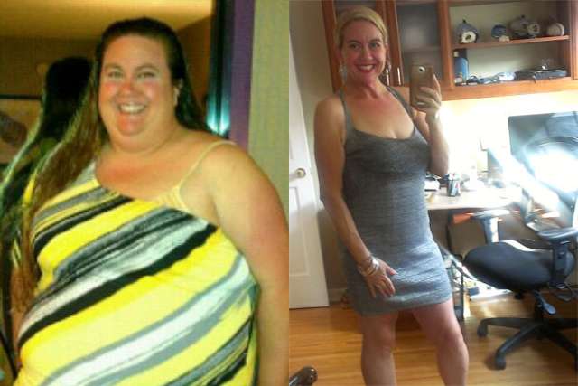 Michelle's Story - Before and After Gastric Bypass Surgery