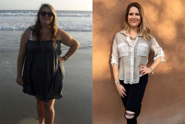 Krystyn's Story - Before and After Gastric Sleeve Surgery