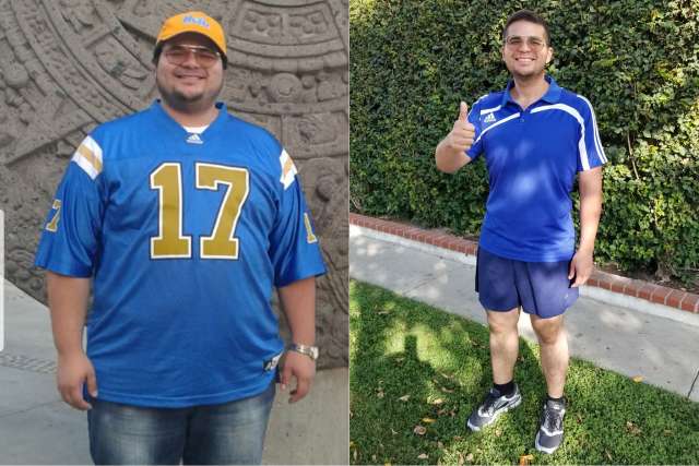 Jose's Story - Before and After Gastric Sleeve Surgery