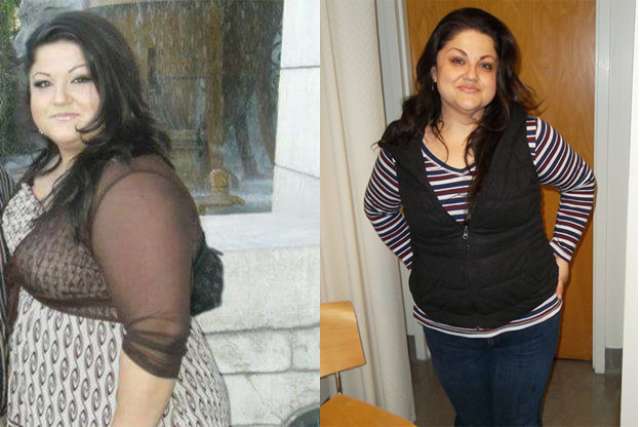 Olga's Story - Before and After Gastric Sleeve Surgery