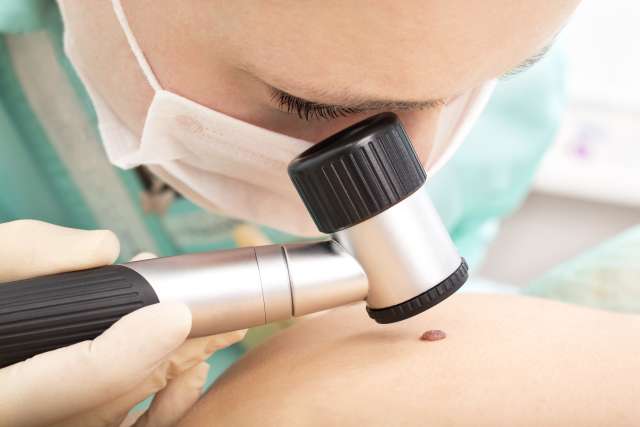 Dermatologist studies birthmark using dermatoscope