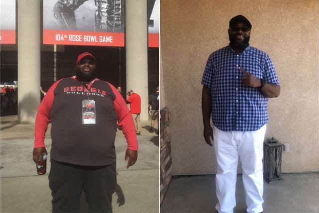 Samuel's Story - Before and After Gastric Sleeve Surgery