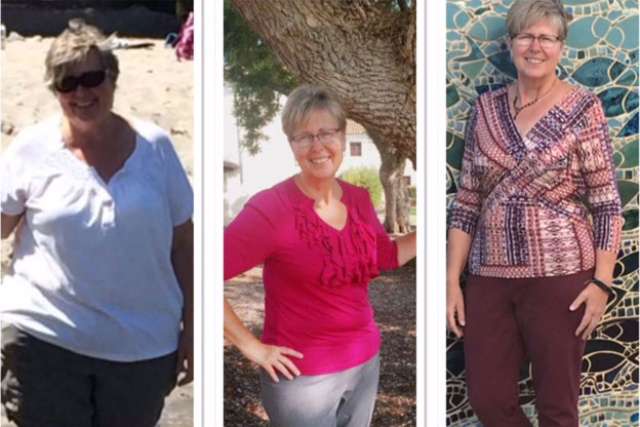 Angelika's Story - Before and After Gastric Sleeve Surgery