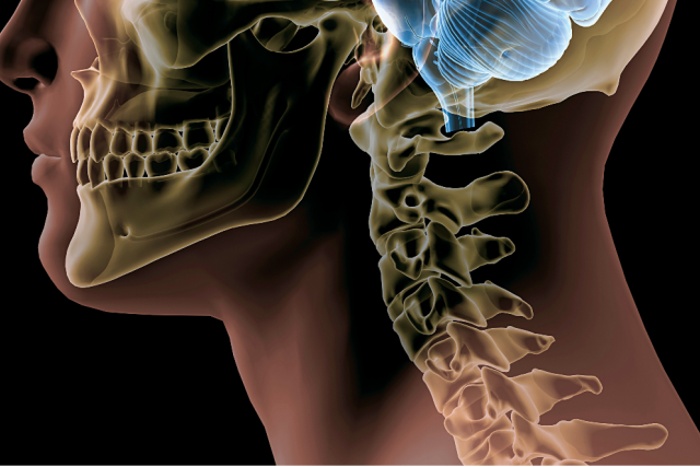 Whether TMD or trismus, jaw trouble needs attention