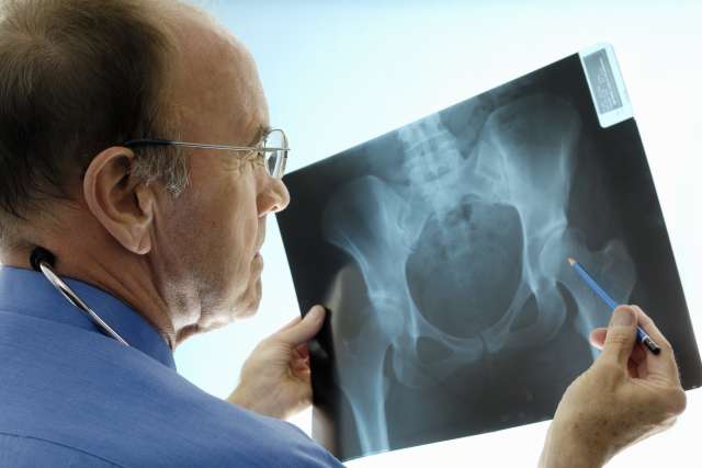 Doctor examining pelvic X-ray film