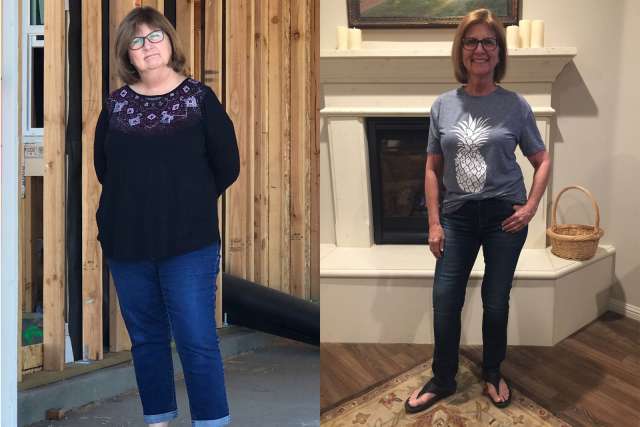 Rebecca's Story - Before and After Gastric Sleeve Surgery