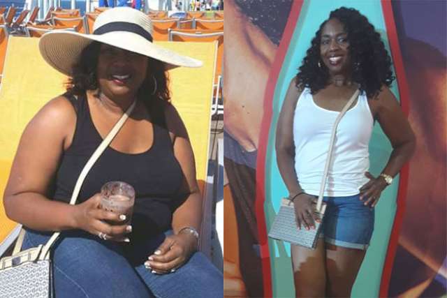 Trinette's Story - Before and After Gastric Sleeve Surgery