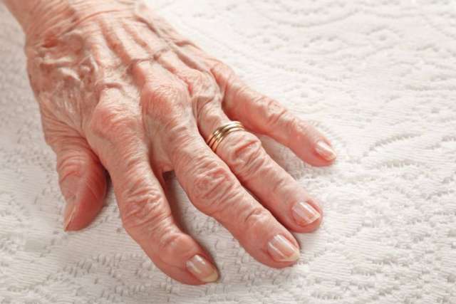 Wrinkled hand with wedding ring on white quilted fabric