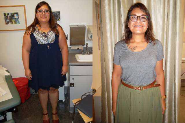 Sarah's Story - Before and After Gastric Sleeve Surgery