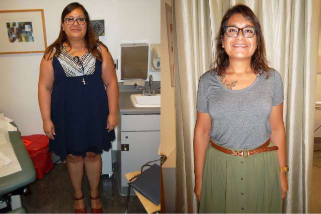 Sarah's Story - Before and After Gastric Sleeve Surgery