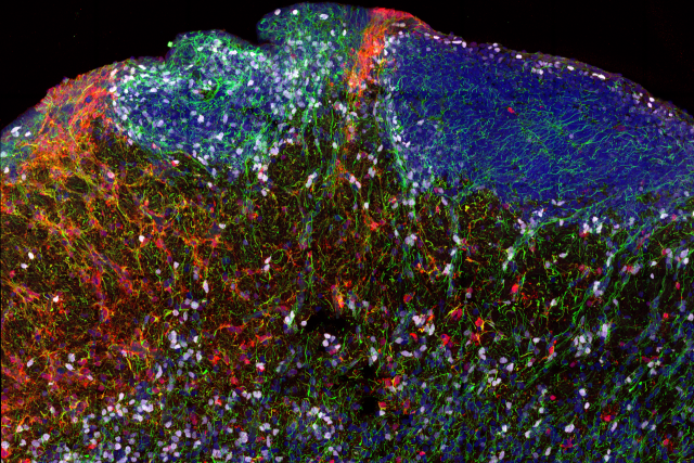 Fluorescent image showing diverse cell types in a human brain section, with various cells highlighted in different colors, demonstrating the intricate cellular composition of the brain.