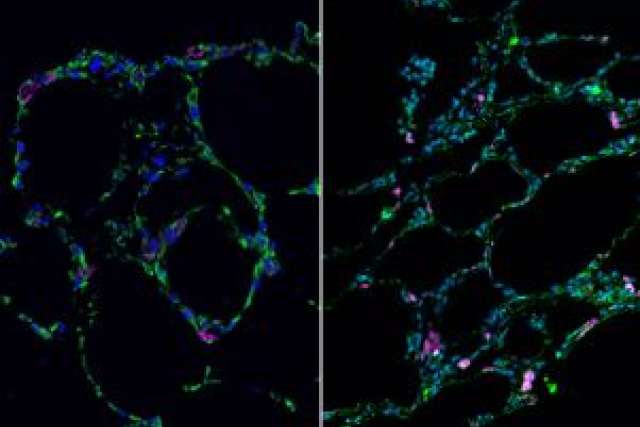 Two microscopic images showing bioengineered lung-like tissue structures in vibrant colors.