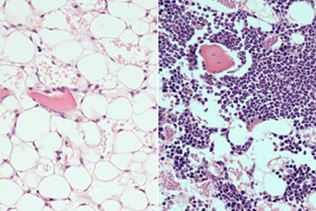 Blood cell recovery