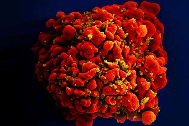 T cell infected with HIV