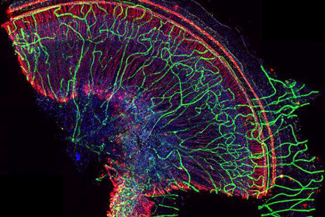 Cochlea