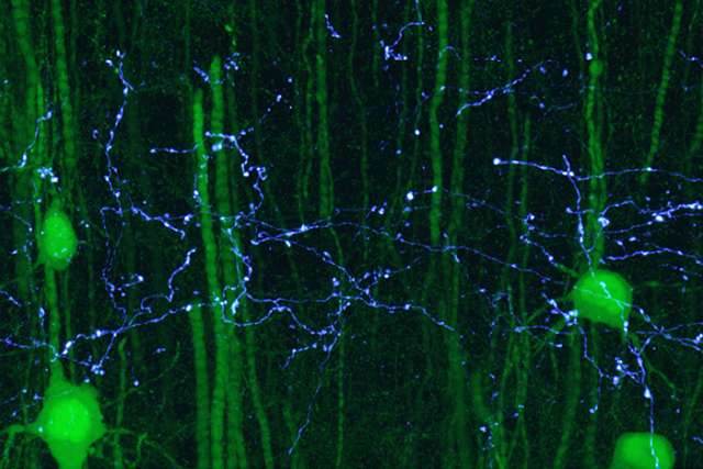 Axons and neurons