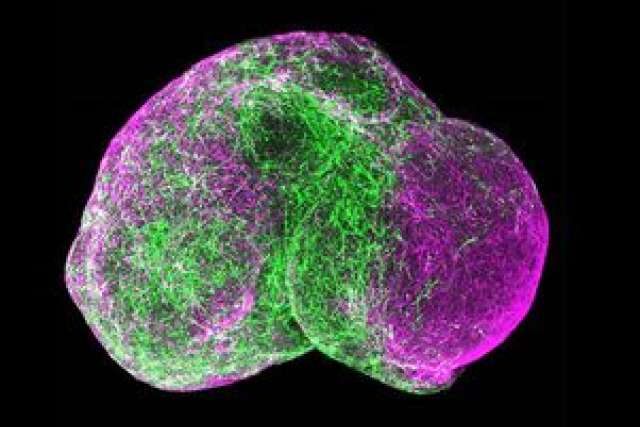 Forebrain spheroid Stanford with fluorescent green filaments and magenta cell clusters