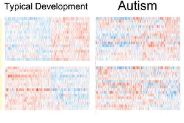 Gene pattern thumbnail: four heatmaps comparing typical development and autism