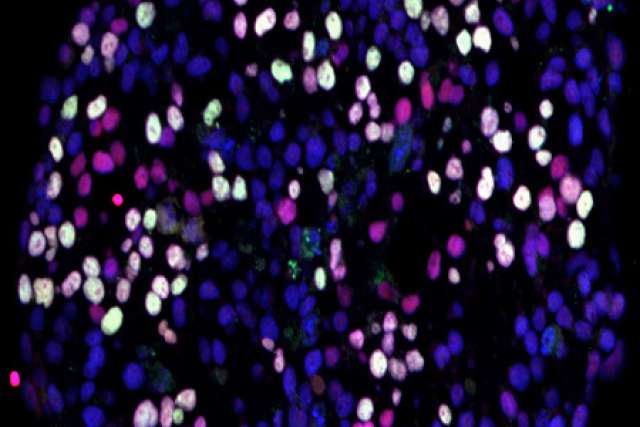 hESCs differentiating into germ cells