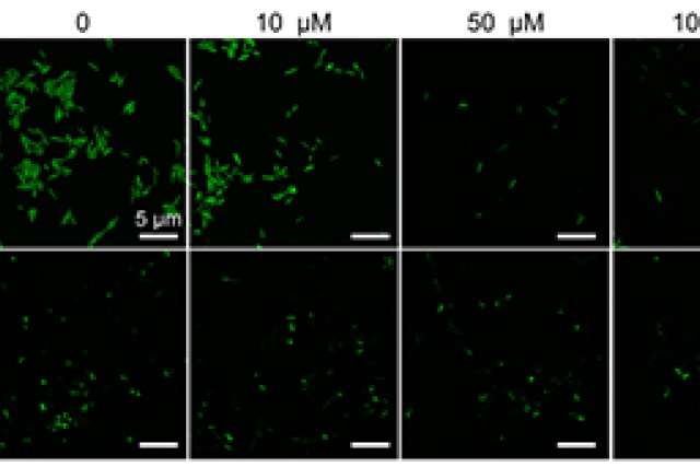Green fluorescence images showing bacterial cell responses at different concentrations.
