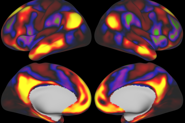Image of brain functional connectivity that is being collected from the study.