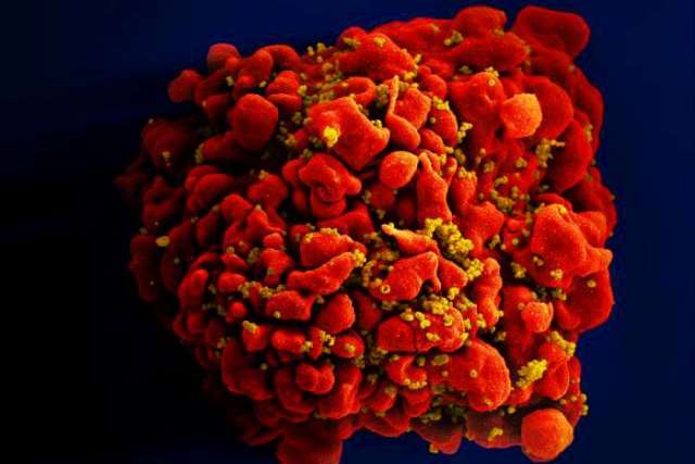 T-cell infected with HIV