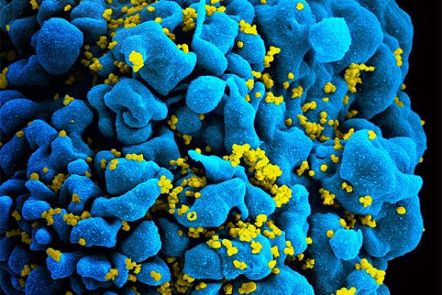 HIV-infected T cell