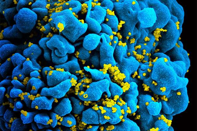 HIV-infected T cell