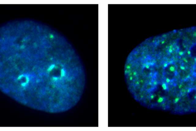 Images of cells with and without KDM4A