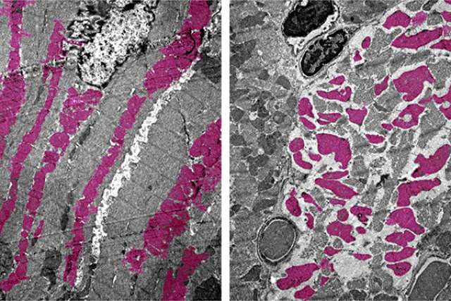 Heart muscle cells in mice