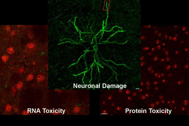 RNA and protein toxicities leading to neuronal damage