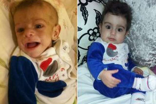 Before and after photos of a child in blue clothing, showing growth and development.