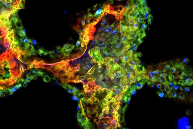Nanoparticles on scaffold