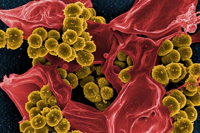 Electron microscope image of MRSA