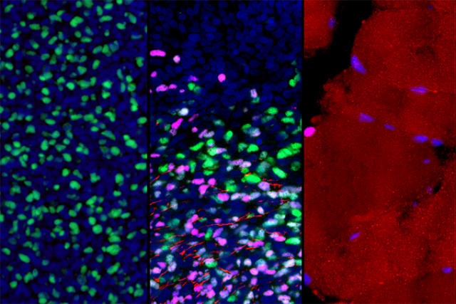 Scientific illustration showing the progression and differentiation of muscle stem cells into various muscle cell types.